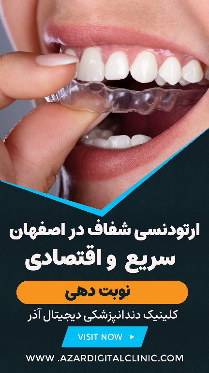 ارتودنسی شفاف در اصفهان کلینیک دندانپزشکی دیجیتال آذر